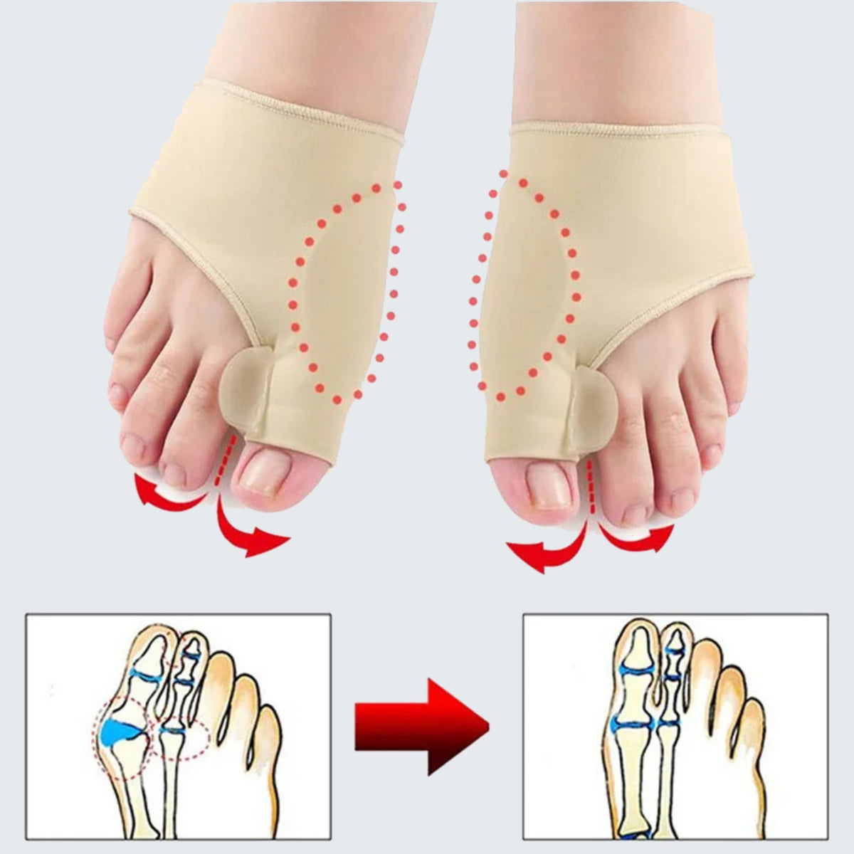 Tala Ortopédica para Joanetes