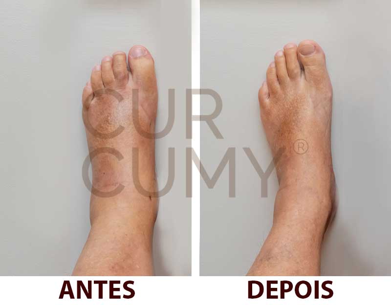 CURCUMY® - Fórmula Avançada para o Combate das Dores - LEVE 3 e PAGUE 2